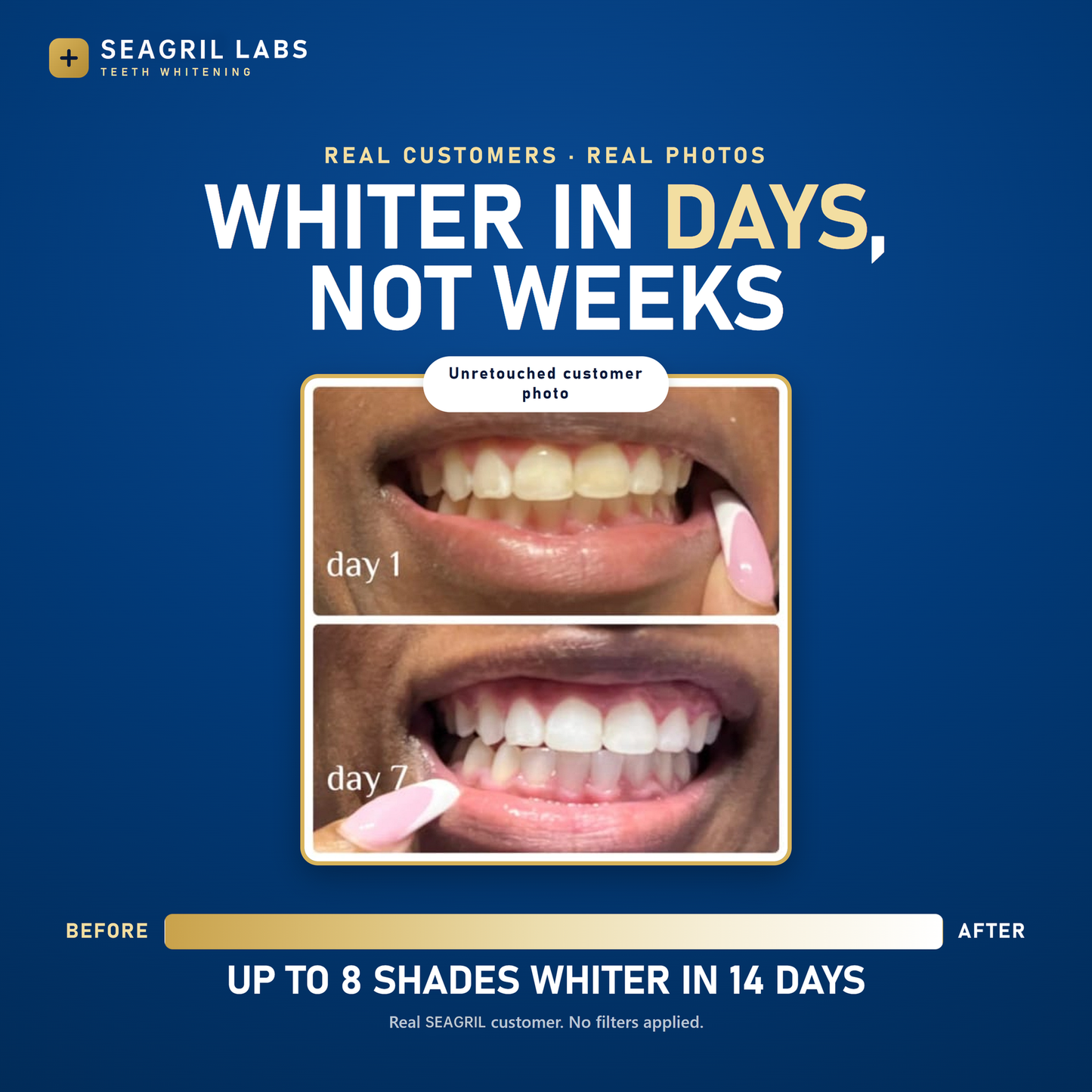 SEAGRIL™ Pro Gold Whitening Pen